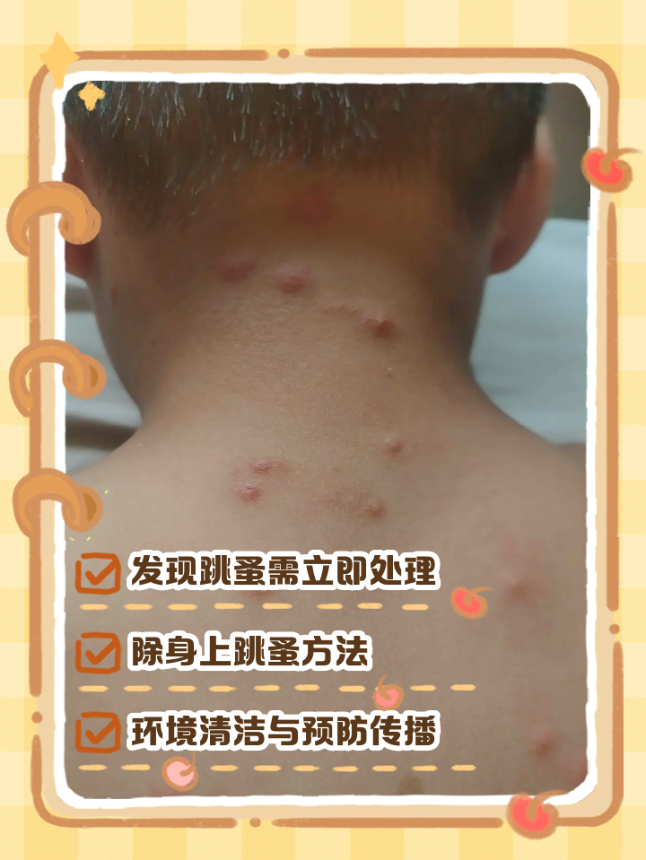 狗身上的跳蚤怎么去除,猫和狗身上的跳蚤怎么去除