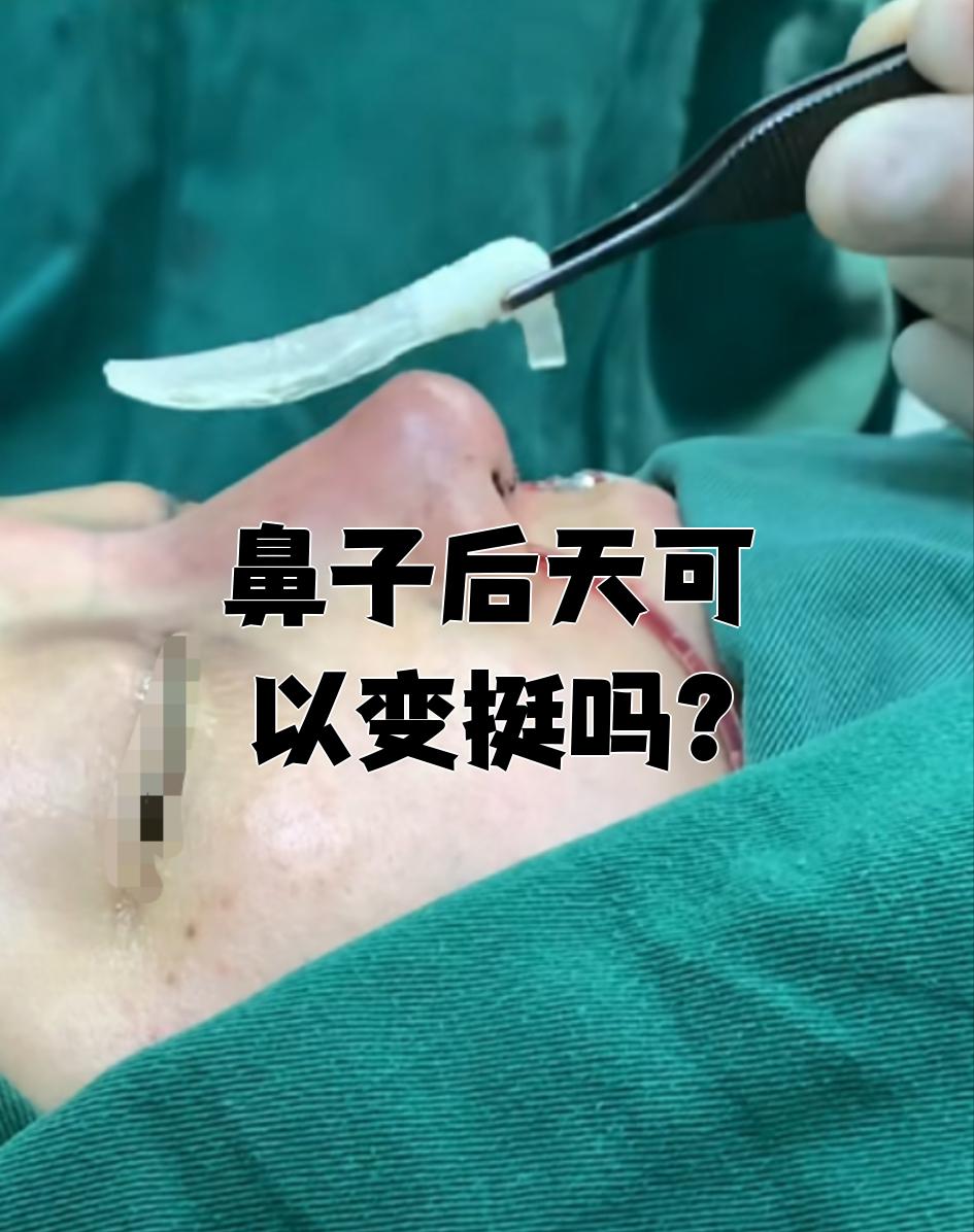使鼻子变挺的小窍门,有没有?,使鼻子变挺的小窍门,有没有方法改善