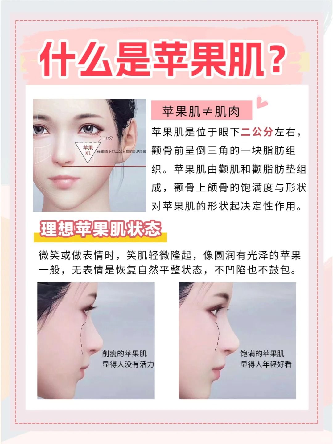 苹果肌长在什么地方