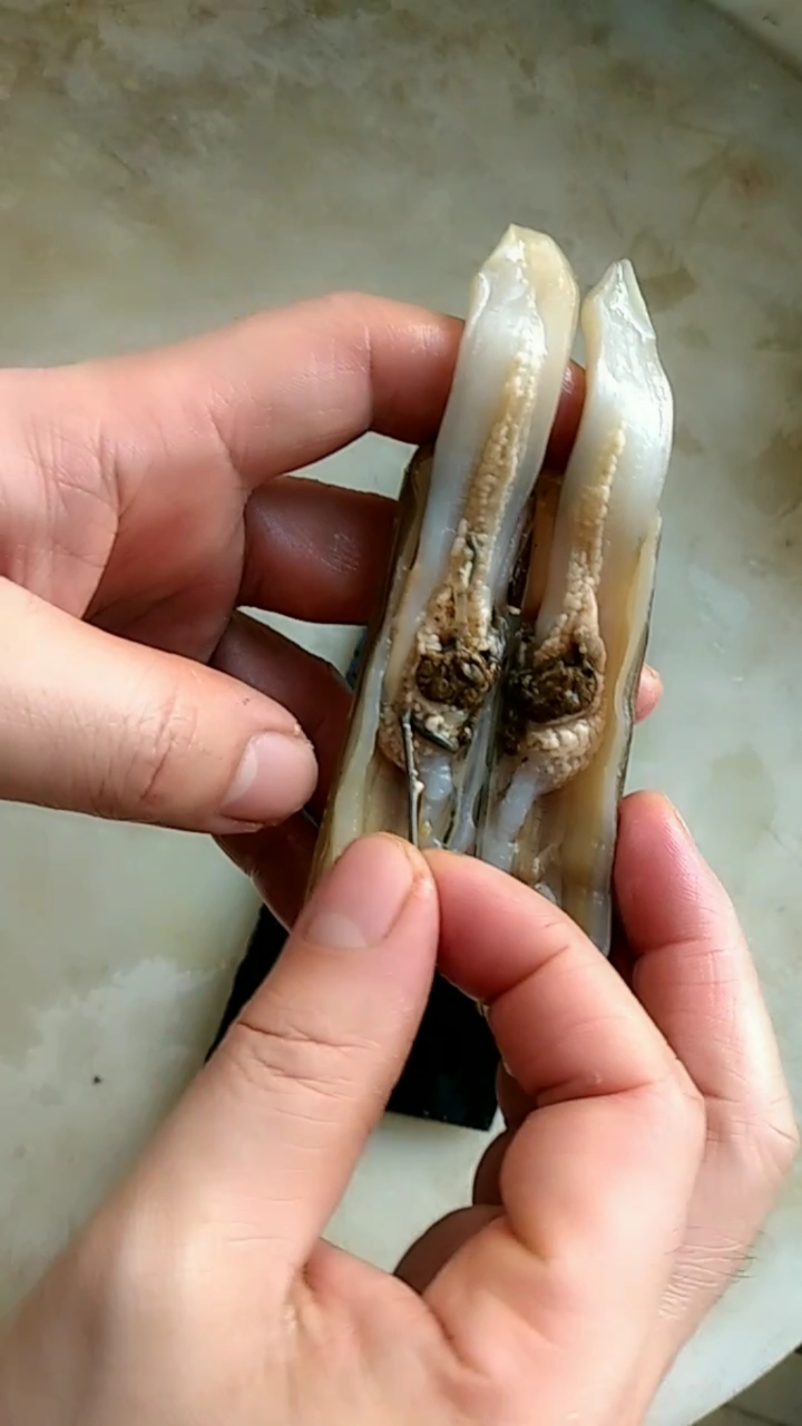 蛏子什么部位不能吃,蛏子什么部位不能吃了