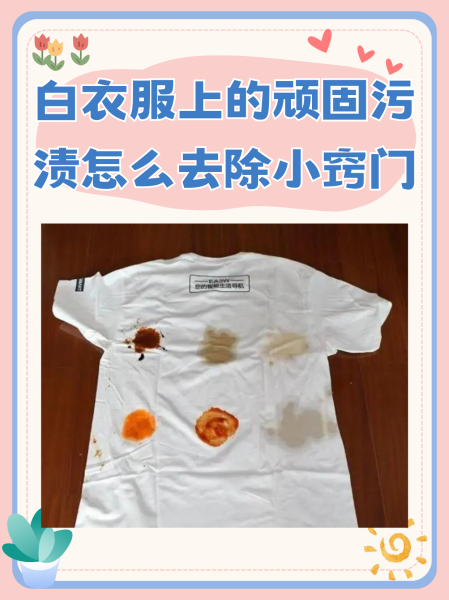 白色衣服上的污渍怎么才能去掉？,白色衣服的污渍怎么去除小窍门