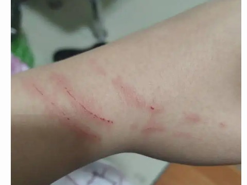 梦见自己被猫咬了手是什么兆头,梦到自己被猫咬到手了,怎么破解