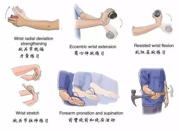 肘过伸的含义,肘过伸有什么影响