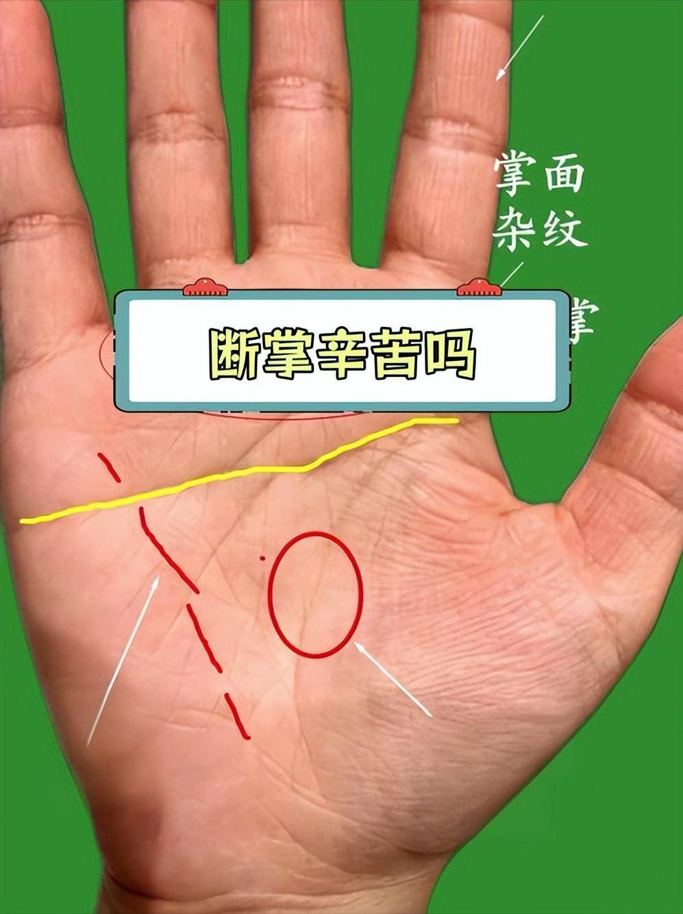 男的断掌代表的意思,男人断掌断掌命运好不好?