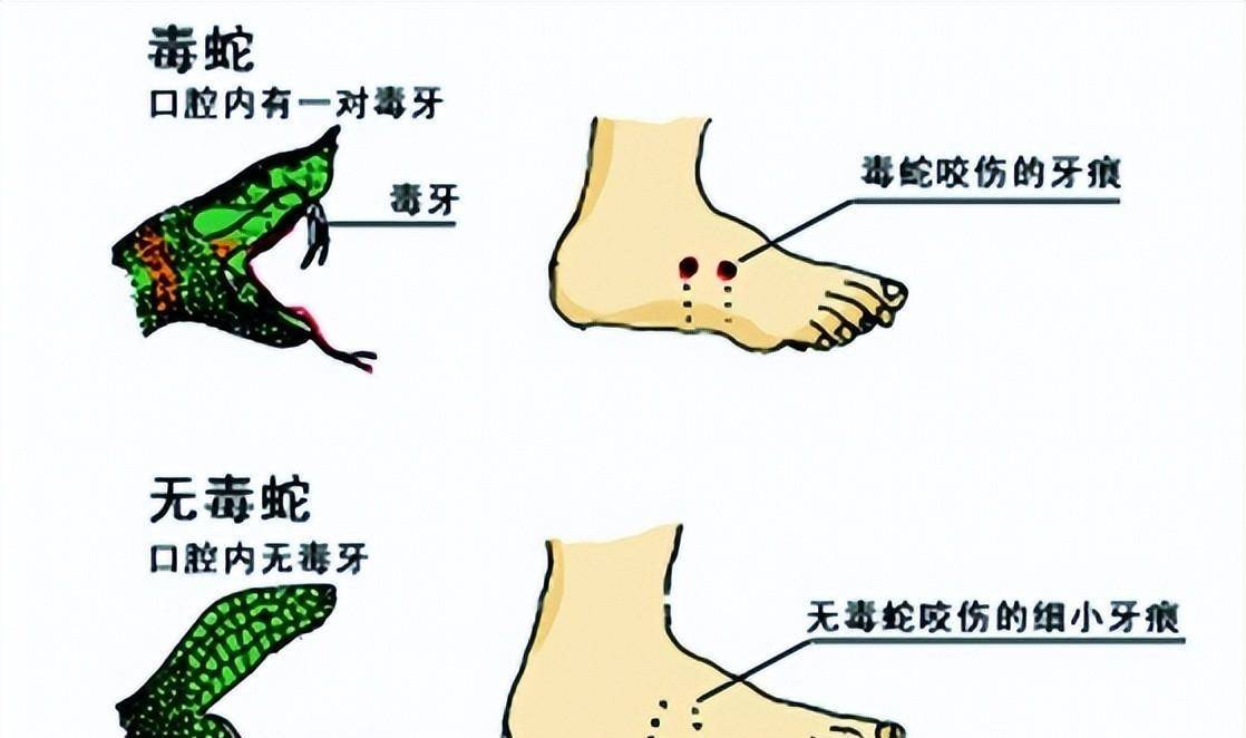 被蛇咬伤怎么办,不确定是不是被蛇咬伤怎么办