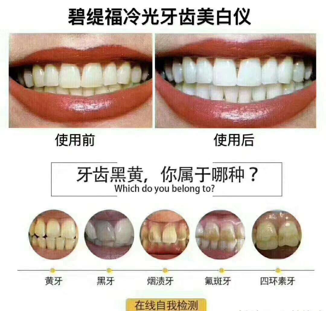 碧缇福美牙仪好用吗碧缇福美牙仪原理,