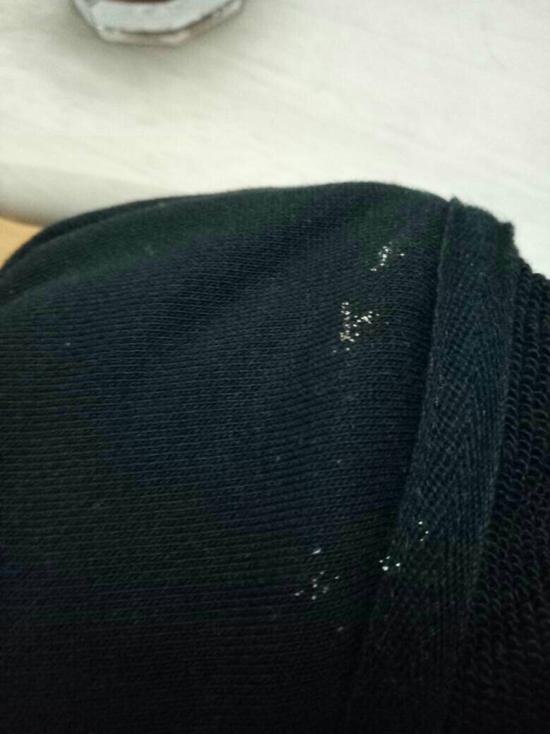 衣服上有虫卵还能要吗,衣服上长虫卵对人有什么害处