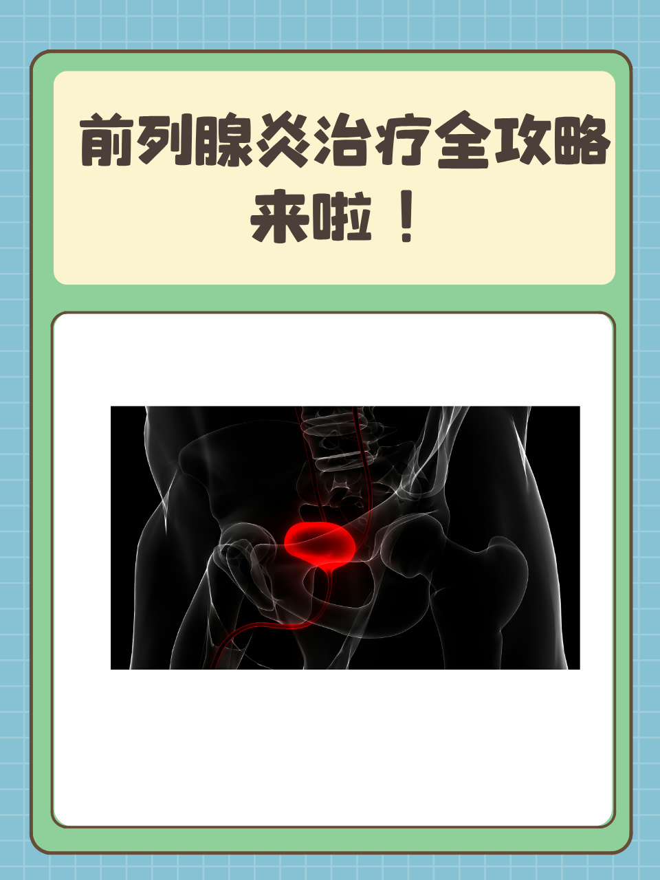 前列腺炎的自我疗法,前列腺炎的自我疗法是什么