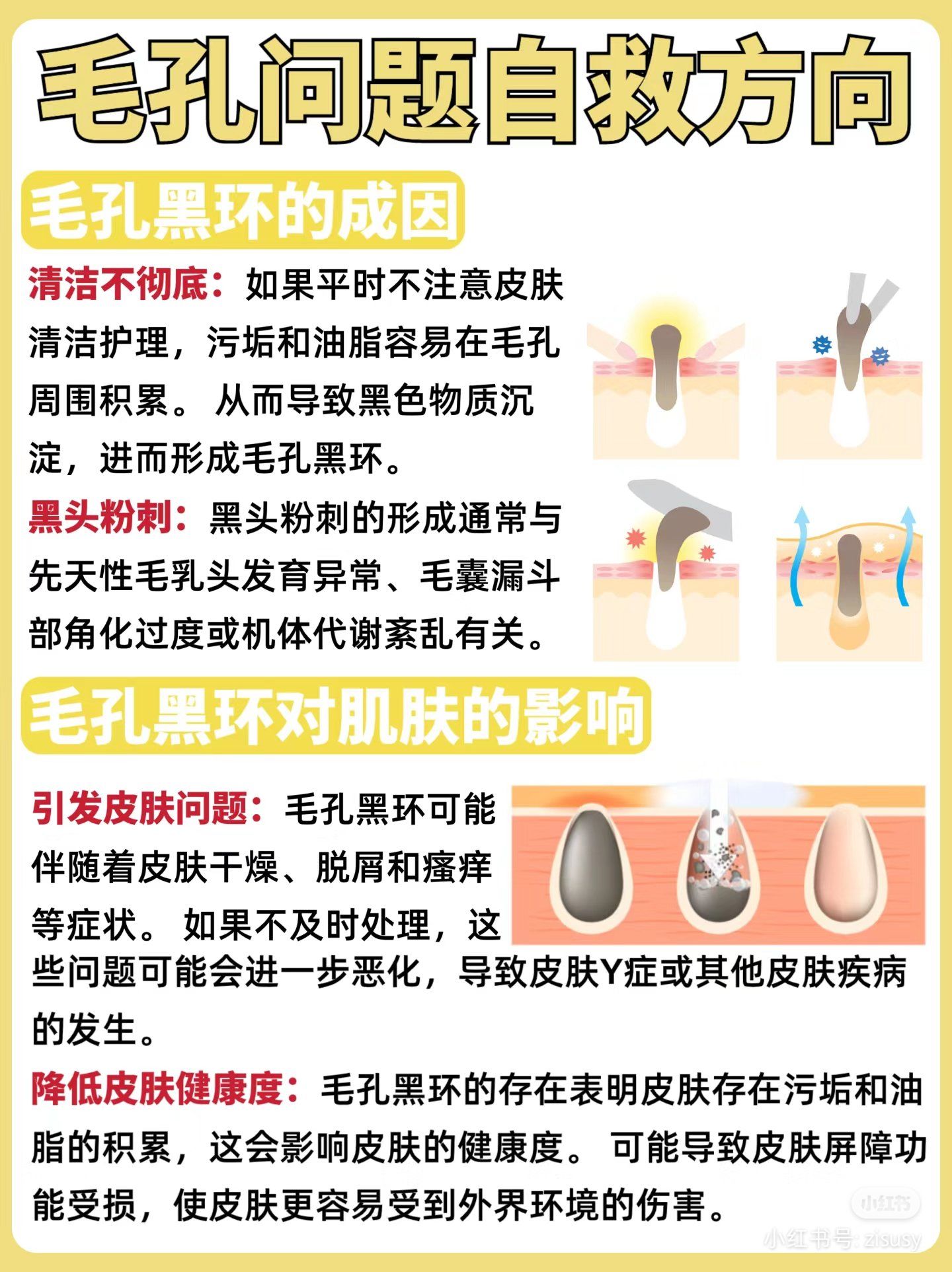 去黑头效果好的方法去黑头最有效的方法小窍门,