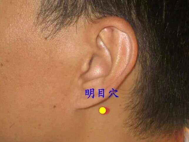 平衡针灸平衡针灸治疗针刺针感,